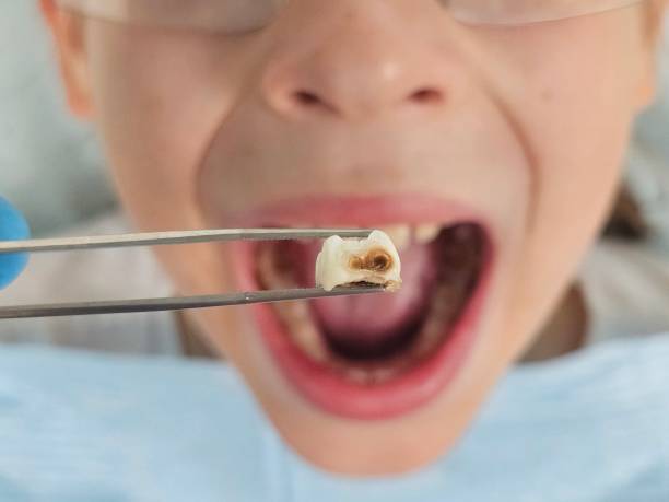 Best After-Hours Dental Trauma Care in Leupp, AZ